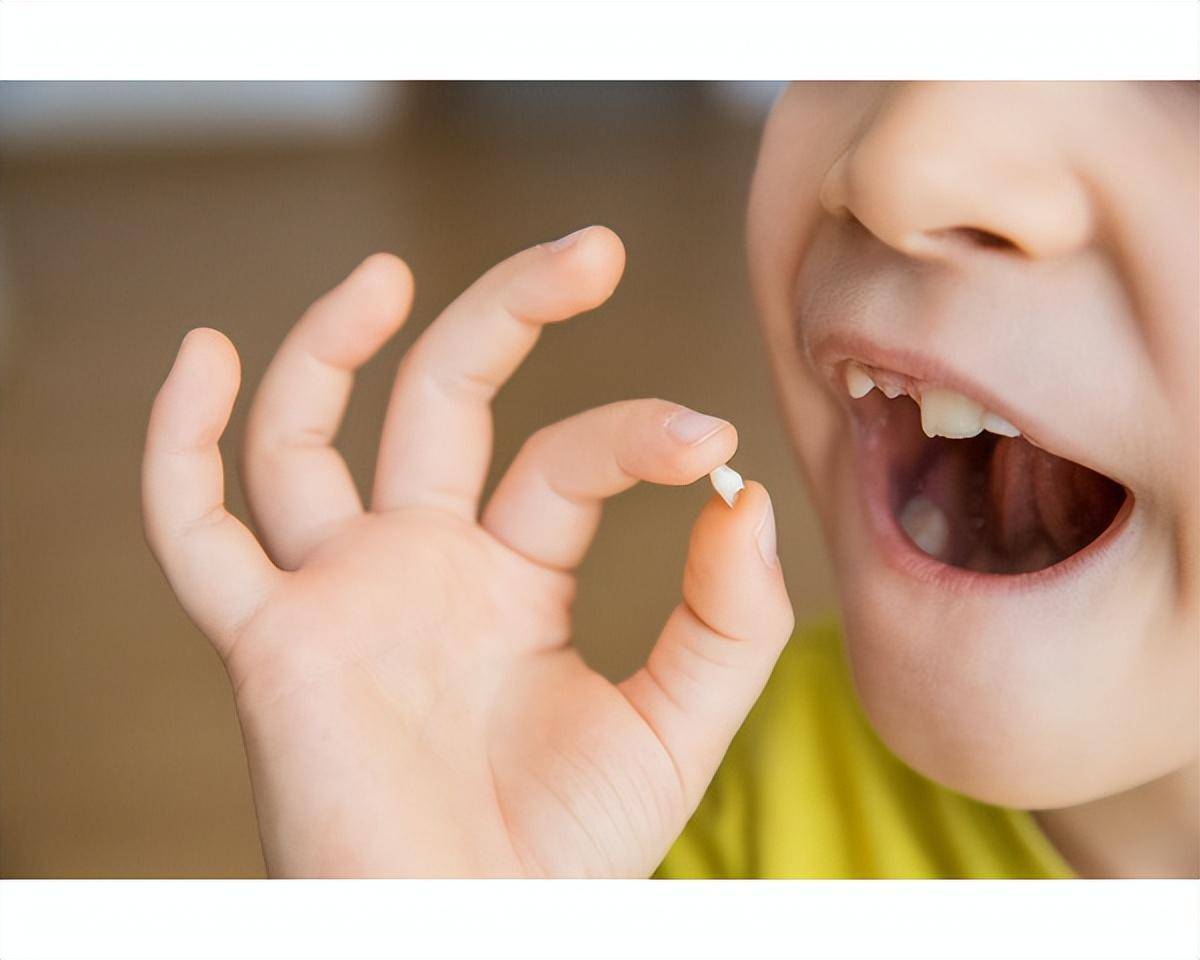 Early Childhood Caries | Hurst Pediatric Dentistry