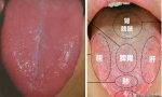 舌头上有裂纹是怎么回事（专业人员来为你讲解明白）缩略图