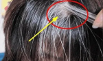 头发变白是什么原因（教你从根本上解决白发问题）缩略图