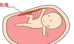 胎儿的生长指标是什么（为你详细介绍胎儿的生长指标）缩略图