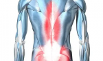 腰部肌肉疼怎么办（推荐你缓解疼痛的3个方法）缩略图